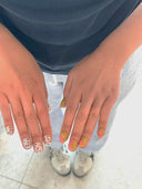 Close-up of two hands with dragon fruit press-on nails on a blurred background